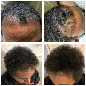 Ayurvedic Hair Mask + Pre-Mature Hair Growth Oil