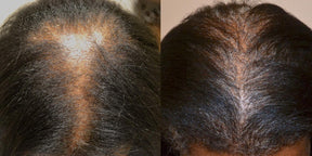 Hello Strength - Breakage Defense Hair Oil