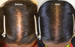 Hello Strength - Breakage Defense Hair Oil